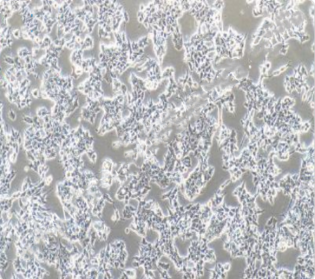 22Rv1 人前列腺癌细胞传代、复苏操作