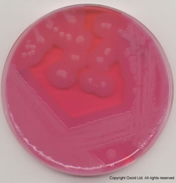 蜡样芽孢杆菌在myp琼脂平板上的生长:对食品中的蜡状芽孢杆菌进行计数