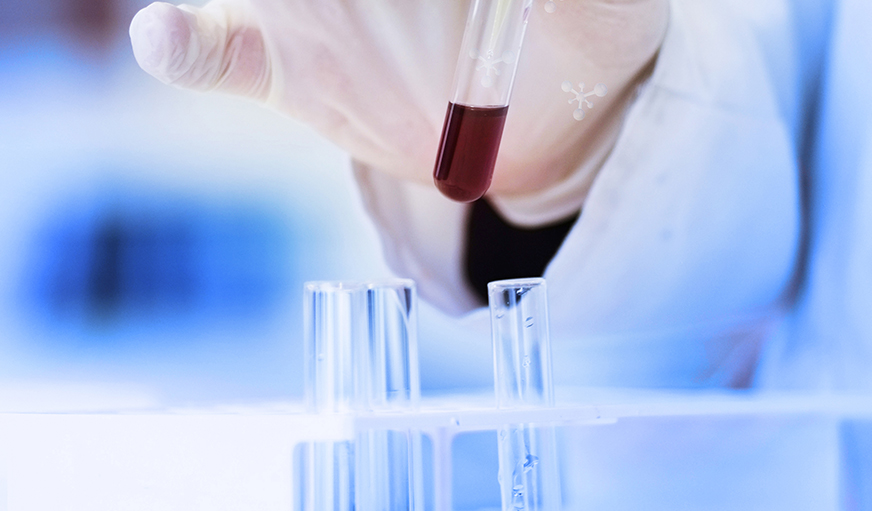 我国体外诊断行业高速发展