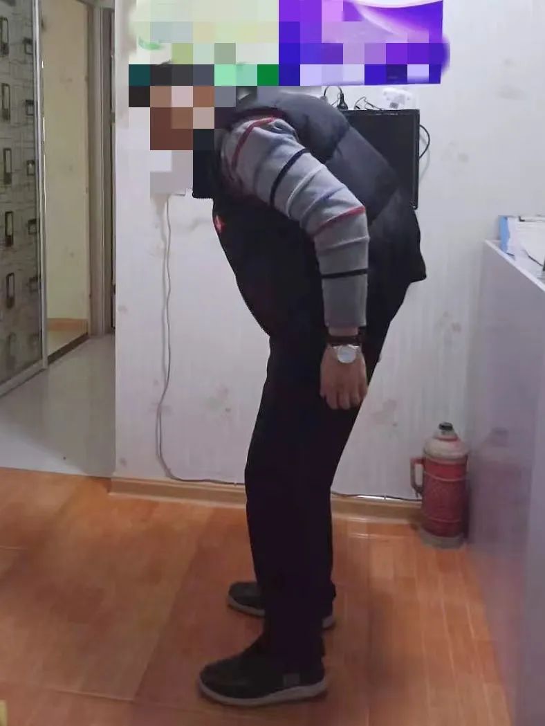 告别被「折叠」的 28 年,湄潭家礼医院为患者成功施行矫形手术