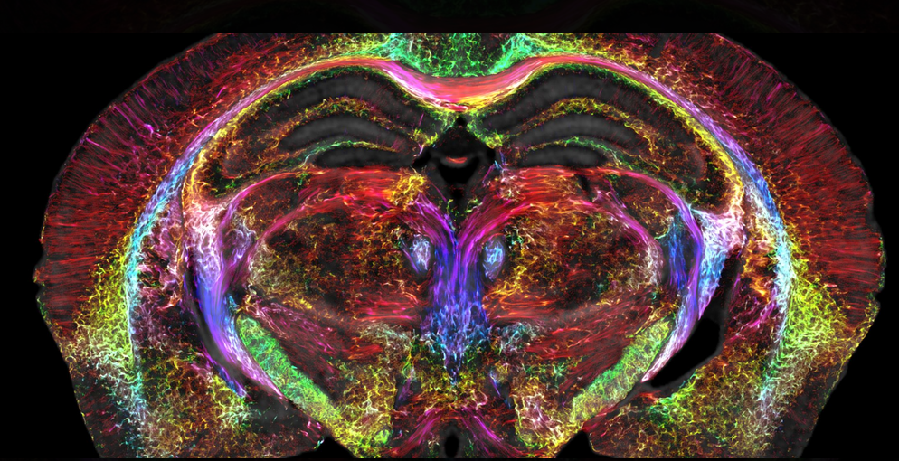 CNS 快讯 | 分辨率提高 6400 万倍迄今最清晰鼠脑图像发布