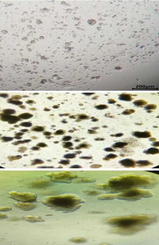 胃癌类器官培养基试剂盒