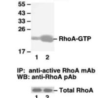 RhoA Activation Assay Kit