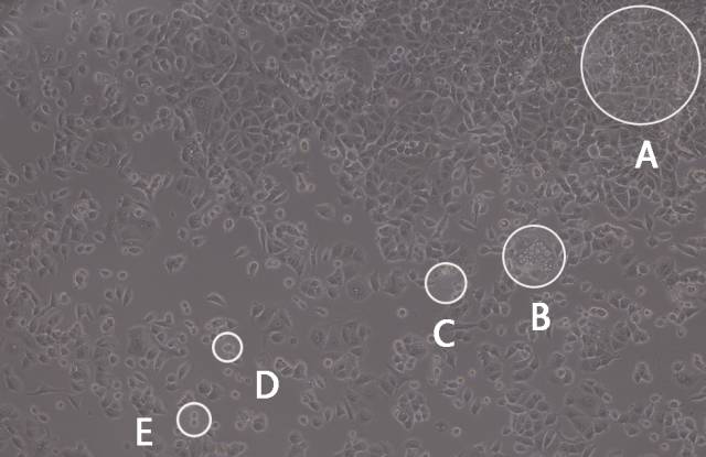 通过辨别细胞生长状态避免细胞死亡的方法技巧