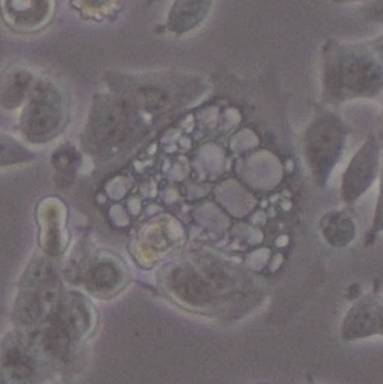 通过辨别细胞生长状态避免细胞死亡的方法技巧