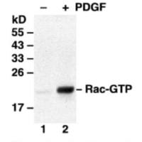 Rac Activation Assay Kit