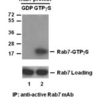 Rab7 Activation Assay Kit