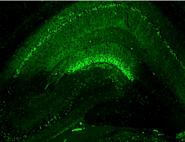 Biotium丨艾美捷阴离子绿色荧光染料解决方案