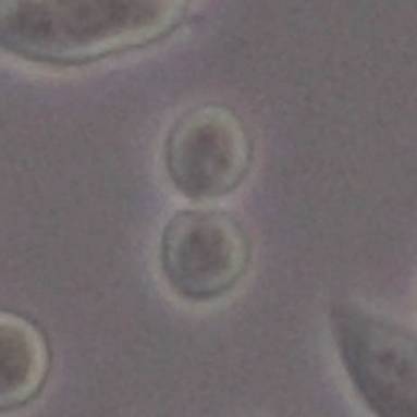 通过辨别细胞生长状态避免细胞死亡的方法技巧