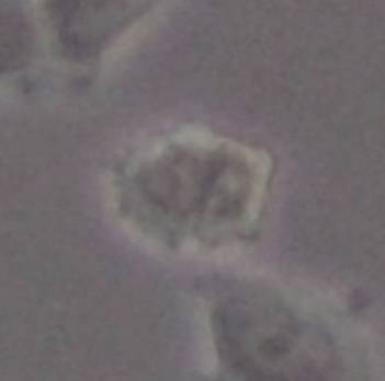 通过辨别细胞生长状态避免细胞死亡的方法技巧