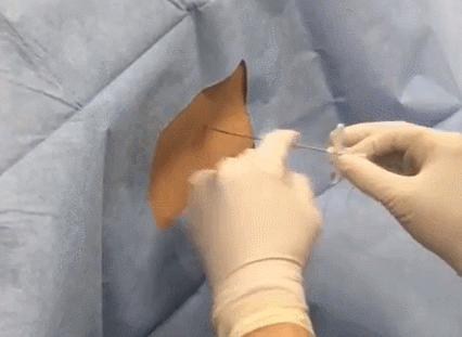 天津美津宜和妇儿医院：生孩子到底有多疼？