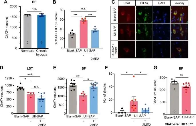 Nature子刊:阻塞性睡眠呼吸暂停(OSA)和阿尔茨海默病(AD)的联系