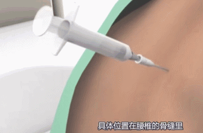 天津美津宜和妇儿医院：生孩子到底有多疼？