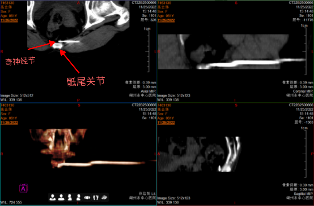 这种痛难以启齿？健康比面子更重要！