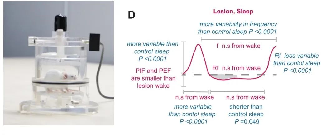 全身体积描记系统在睡眠呼吸暂停（OSA）方面的应用