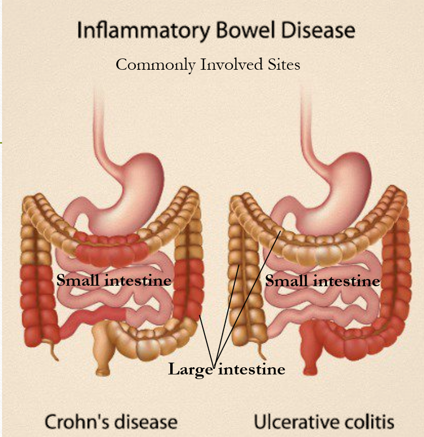 从病因到治疗，药康炎症性肠病小鼠模型（IBD）助力科研