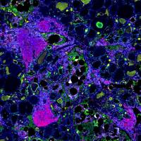 Absin多重荧光免疫组化服务