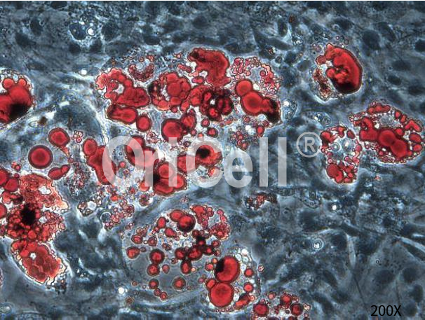 【新课预告】成脂诱导分化闯关技巧及应用进展