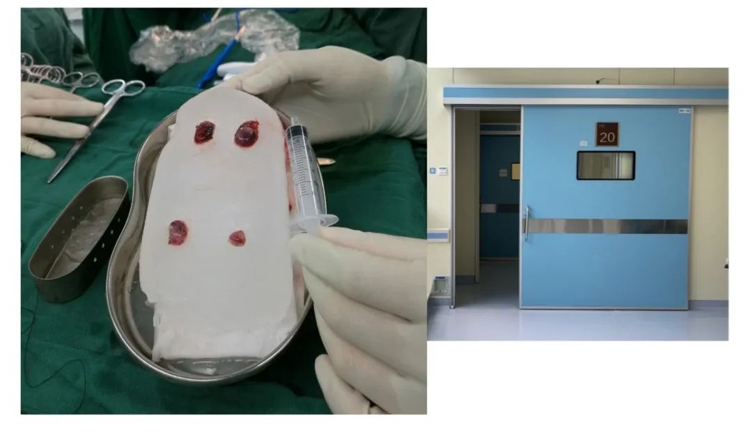 医生从甲状腺取出四颗「黄豆」，成功移植到手臂上！