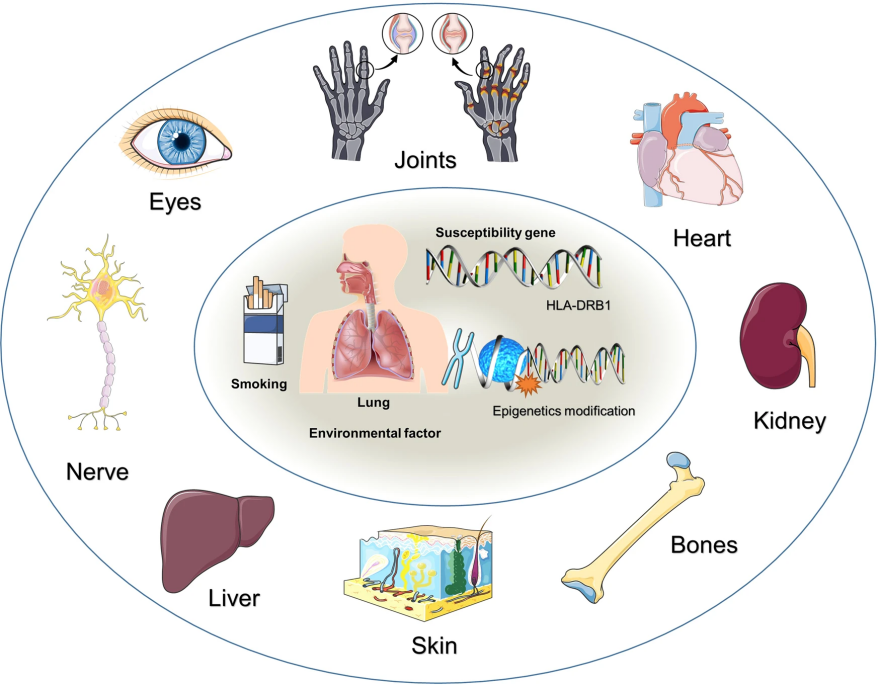 关于RA动物模型探索类风湿性关节炎发病机制与治疗，你一定要知道！