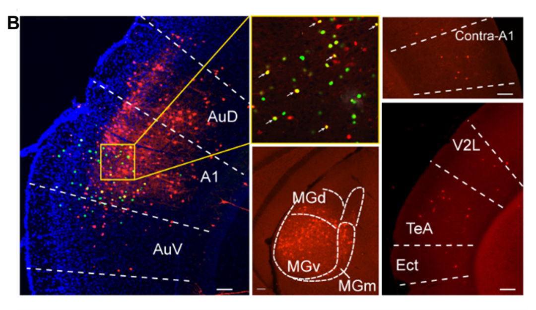 科技前沿 | VS200助力揭示心理韧性的环路机制