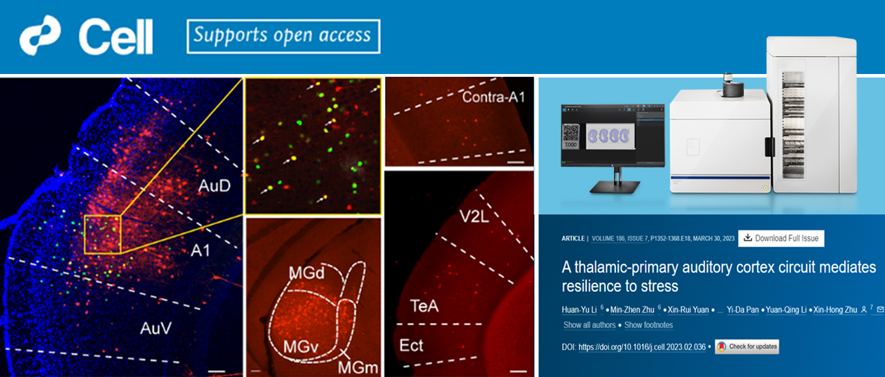 科技前沿 | VS200助力揭示心理韧性的环路机制