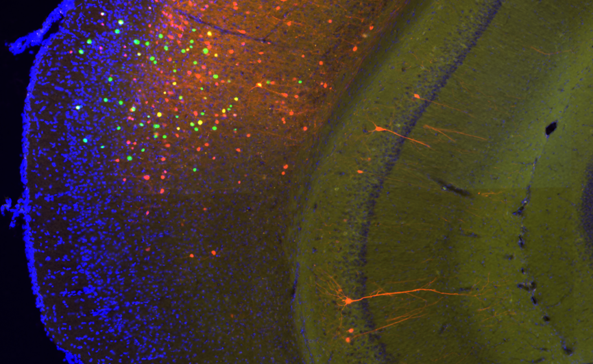 科技前沿 | VS200助力揭示心理韧性的环路机制