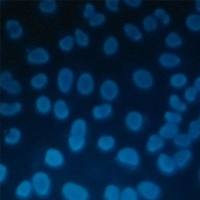 细胞Hochest凋亡染色实验服务