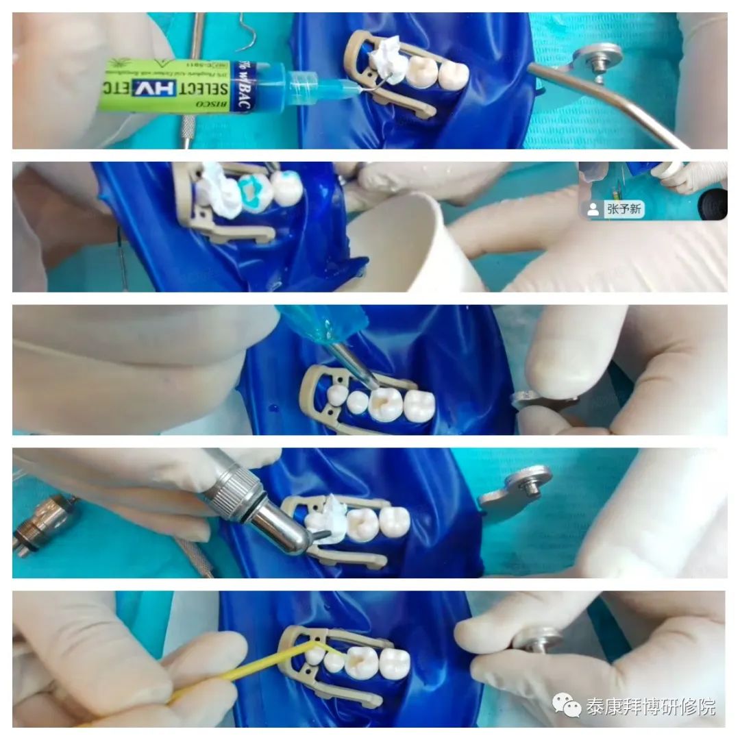 泰康拜博口腔嵌体系列培训第三讲精彩小结