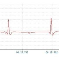 大小鼠心电图