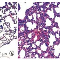 急性肺损伤模型  