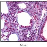 肺纤维化模型  呼吸系统模型