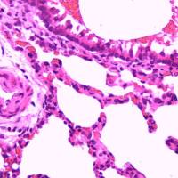 慢性肺阻塞模型  