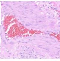 肺动脉高压动物模型动物实验