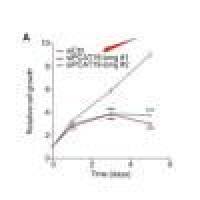 siRNA敲减-WB验证