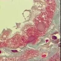 缺血性急性肾衰竭动物模型