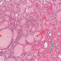 肾小管间质纤维化动物模型 