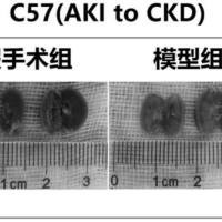 急性肾衰竭动物模型