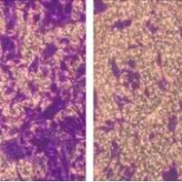 Transwell检测细胞侵袭