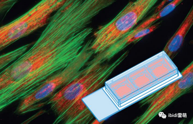 ibidi免疫荧光实验|3孔移除腔室载玻片（细胞培养、固定、染色、成像，快速简便！）