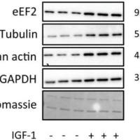 WB（蛋白质免疫印迹）