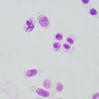 改良ben酚品红染色