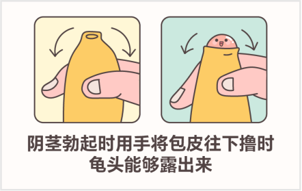 孩子割包皮这事儿，水可真深啊……