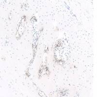 碱性磷酸酶染色