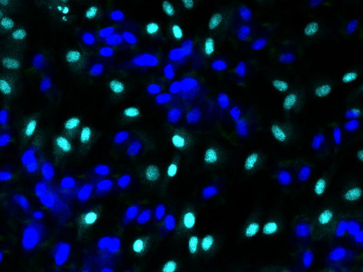 细胞、组织TUNEL凋亡染色实验服务