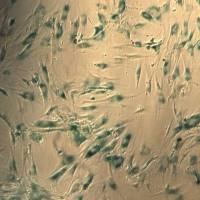 β-半乳糖苷酶染色