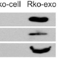 WB验证外泌体靶蛋白