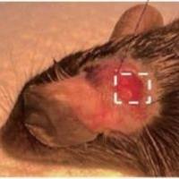 听觉疾病基因治疗