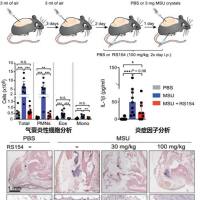 炎症与自身免疫疾病模型