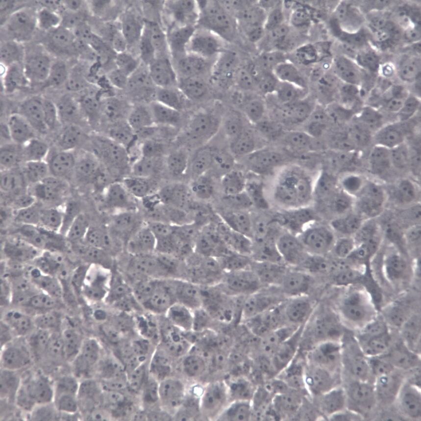 SRA01/04 (HLE)、SRA01/04 (HLE)细胞系、SRA01/04 (HLE)细胞株、SRA01/04 (HLE)S人晶状体上皮细胞[STR]